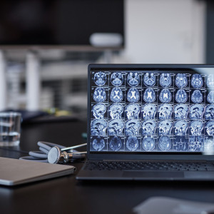 Laptop displaying a grid of brain MRI scans on a desk beside a stethoscope, notebook, and glass of water.
